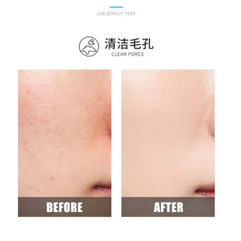 Men Skin Care Essence Milk Moisturizing Repair osvježavajuća hidratantna i glatka serum za lice za cijelu kožu